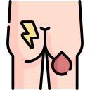 PilonidalSinus