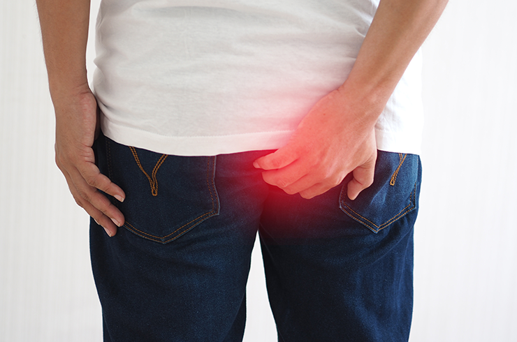 Anal Fissure